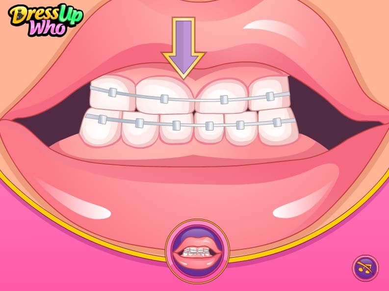 Bad Teeth Makeover - Jogo Gratuito Online  FunnyGames